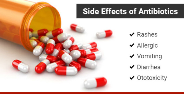 Use Of Antibiotics For Viral Infections.